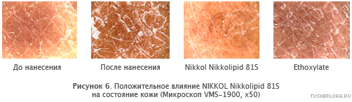 Положительное влияние NIKKOL Nikkolipid 81S на состояние кожи (Микроскоп VMS-1900, x50)